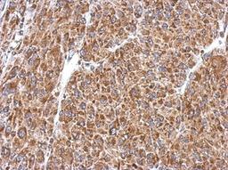 Immunohistochemistry-Paraffin: PIAS2 Antibody [NBP2-19819] - Immunohistochemical analysis of paraffin-embedded U87 xenograft, using antibody at 1:500 dilution.