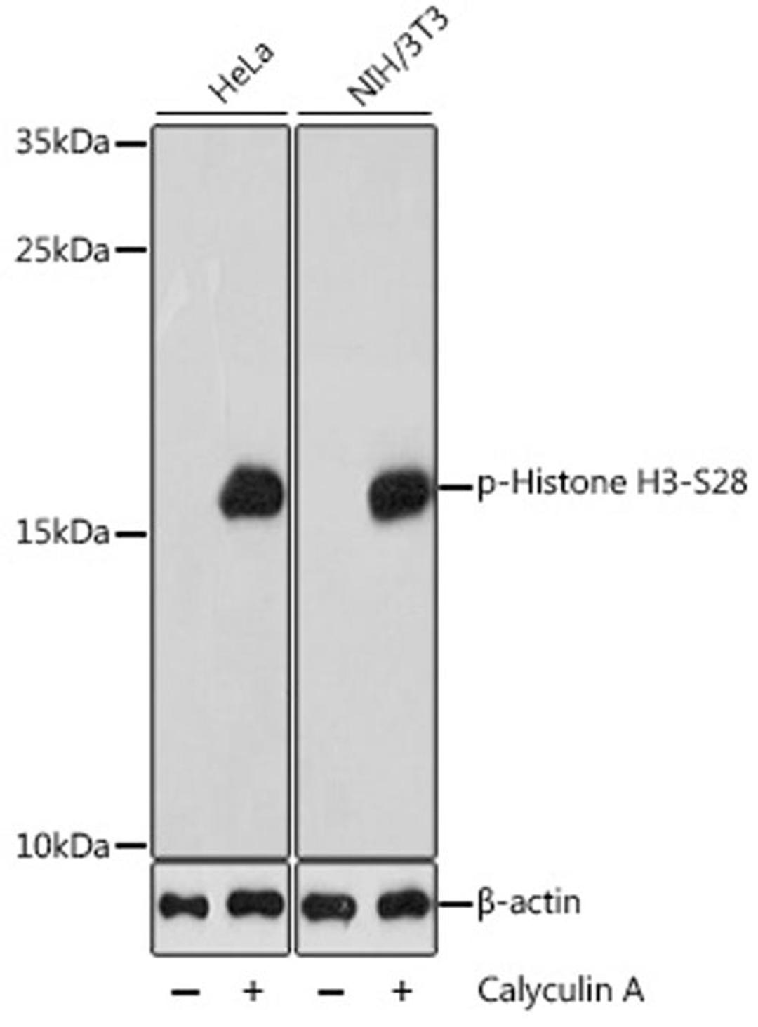 Western blot - Phospho-Histone H3-S28 antibody (AP0839)