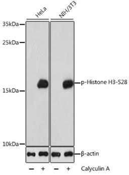 Western blot - Phospho-Histone H3-S28 antibody (AP0839)