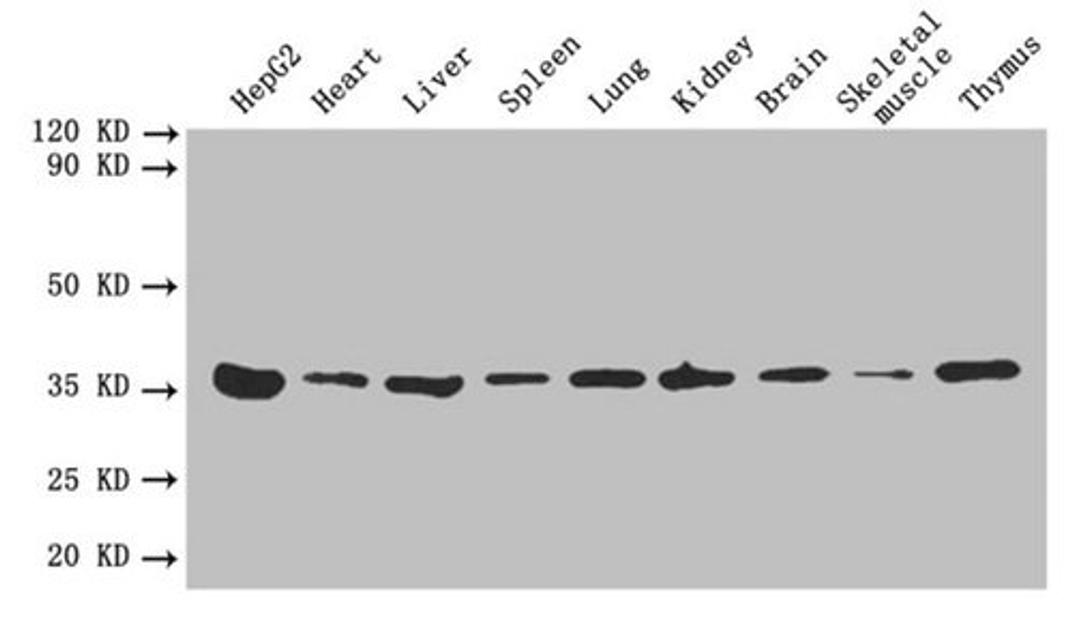 Western blot. All lanes: ANXA5 antibody at 2µg/ml. Lane 1: HepG2 whole cell lysate. Lane 2: Mouse heart tissue. Lane 3: Mouse liver tissue. Lane 4: Mouse spleen tissue. Lane 5: Mouse lung tissue. Lane 6: Mouse kidney tissue. Lane 7: Mouse brain tissue. Lane 8: Mouse skeletal muscle tissue. Lane 9: Mouse thymus tissue. Secondary. Goat polyclonal to rabbit IgG at 1/10000 dilution. Predicted band size: 36 kDa. Observed band size: 36 kDa