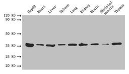 Western blot. All lanes: ANXA5 antibody at 2µg/ml. Lane 1: HepG2 whole cell lysate. Lane 2: Mouse heart tissue. Lane 3: Mouse liver tissue. Lane 4: Mouse spleen tissue. Lane 5: Mouse lung tissue. Lane 6: Mouse kidney tissue. Lane 7: Mouse brain tissue. Lane 8: Mouse skeletal muscle tissue. Lane 9: Mouse thymus tissue. Secondary. Goat polyclonal to rabbit IgG at 1/10000 dilution. Predicted band size: 36 kDa. Observed band size: 36 kDa