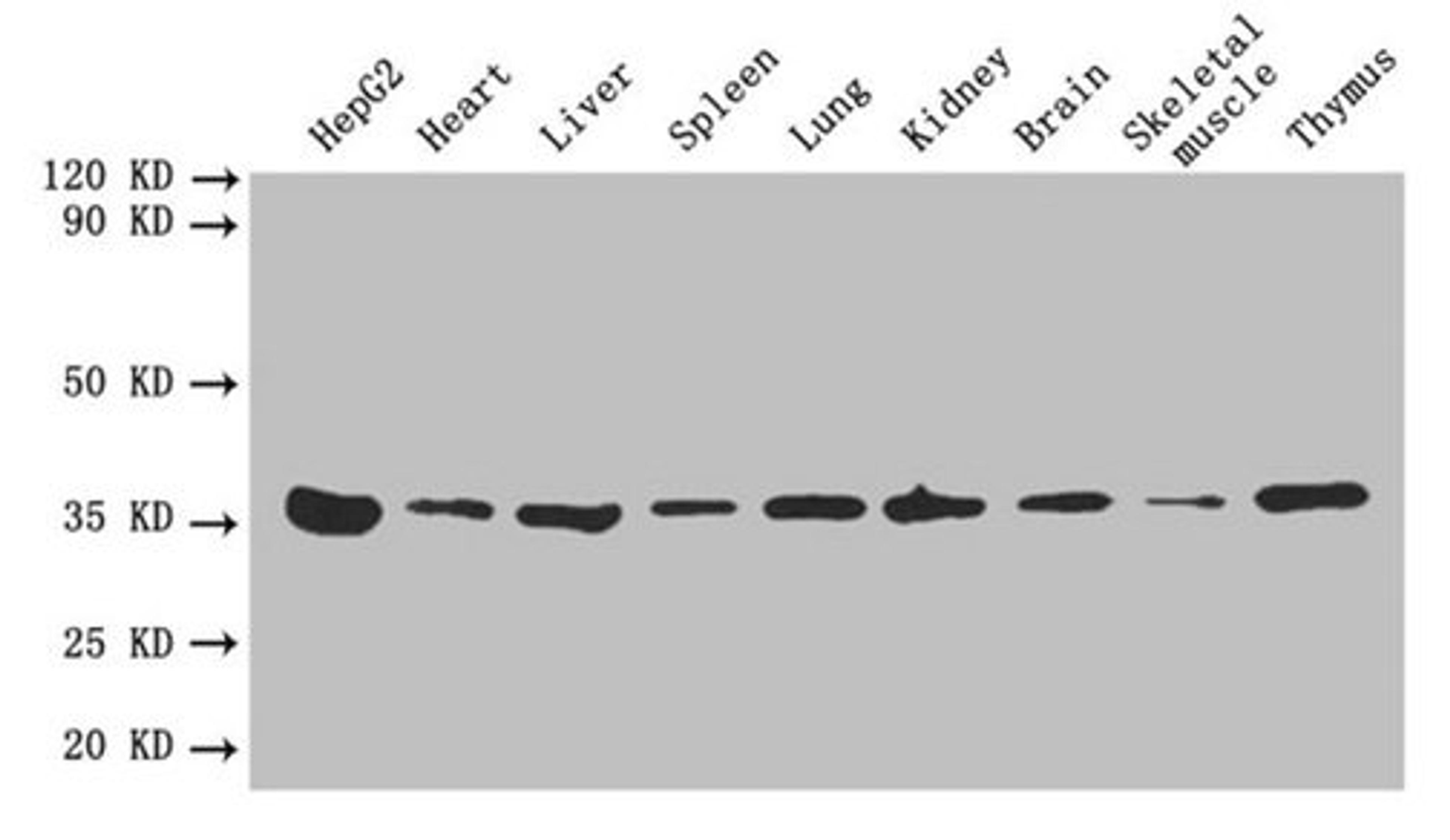 Western blot. All lanes: ANXA5 antibody at 2µg/ml. Lane 1: HepG2 whole cell lysate. Lane 2: Mouse heart tissue. Lane 3: Mouse liver tissue. Lane 4: Mouse spleen tissue. Lane 5: Mouse lung tissue. Lane 6: Mouse kidney tissue. Lane 7: Mouse brain tissue. Lane 8: Mouse skeletal muscle tissue. Lane 9: Mouse thymus tissue. Secondary. Goat polyclonal to rabbit IgG at 1/10000 dilution. Predicted band size: 36 kDa. Observed band size: 36 kDa