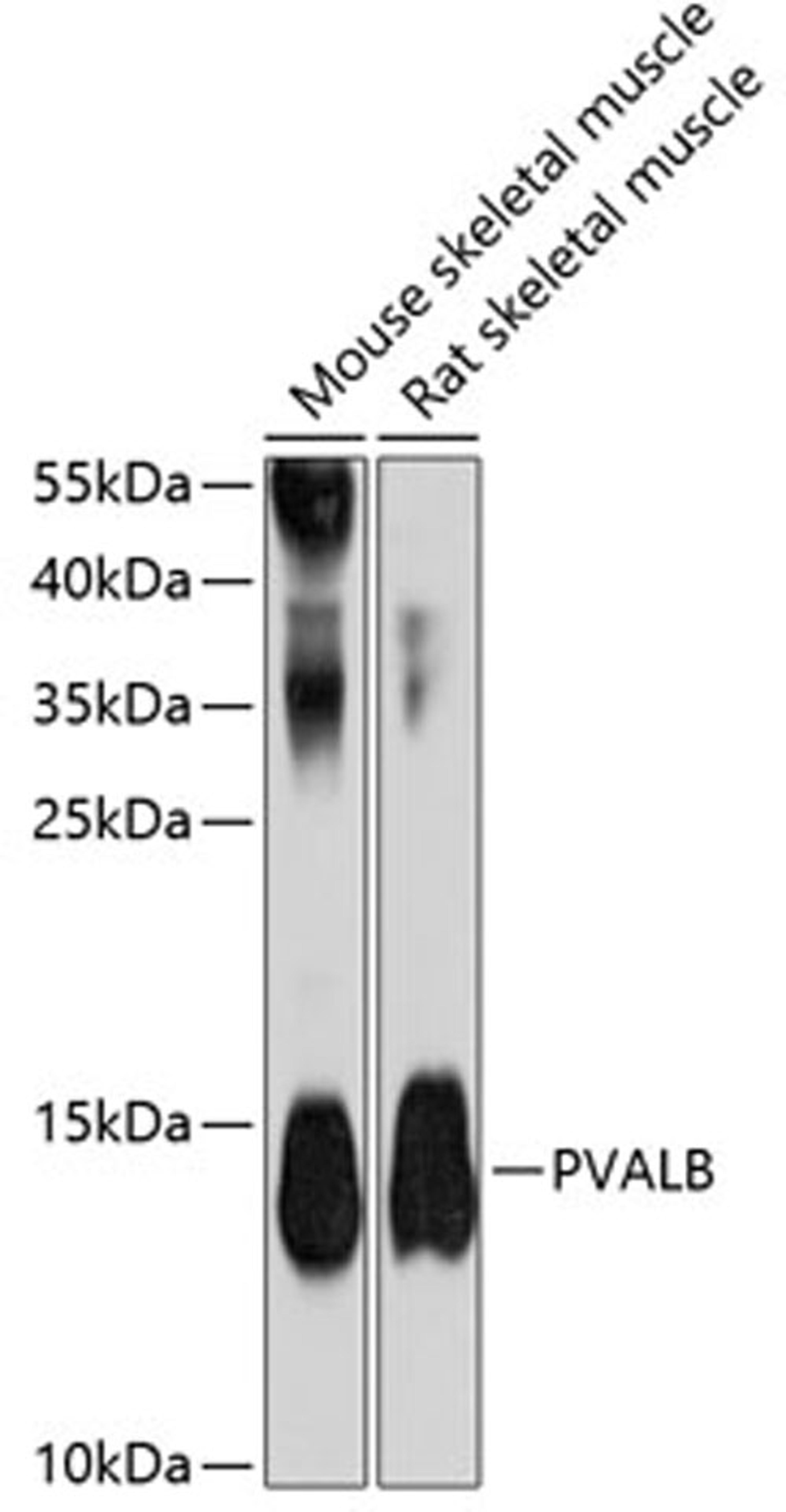 Western blot - PVALB antibody (A13538)