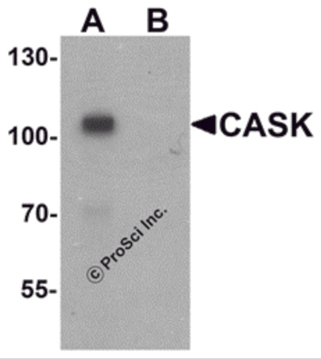 Western blot analysis of CASK in mouse brain tissue lysate with CASK antibody at 1 μg/ml in (A) the absence and (B) the presence of blocking peptide.