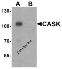 Western blot analysis of CASK in mouse brain tissue lysate with CASK antibody at 1 μg/ml in (A) the absence and (B) the presence of blocking peptide.
