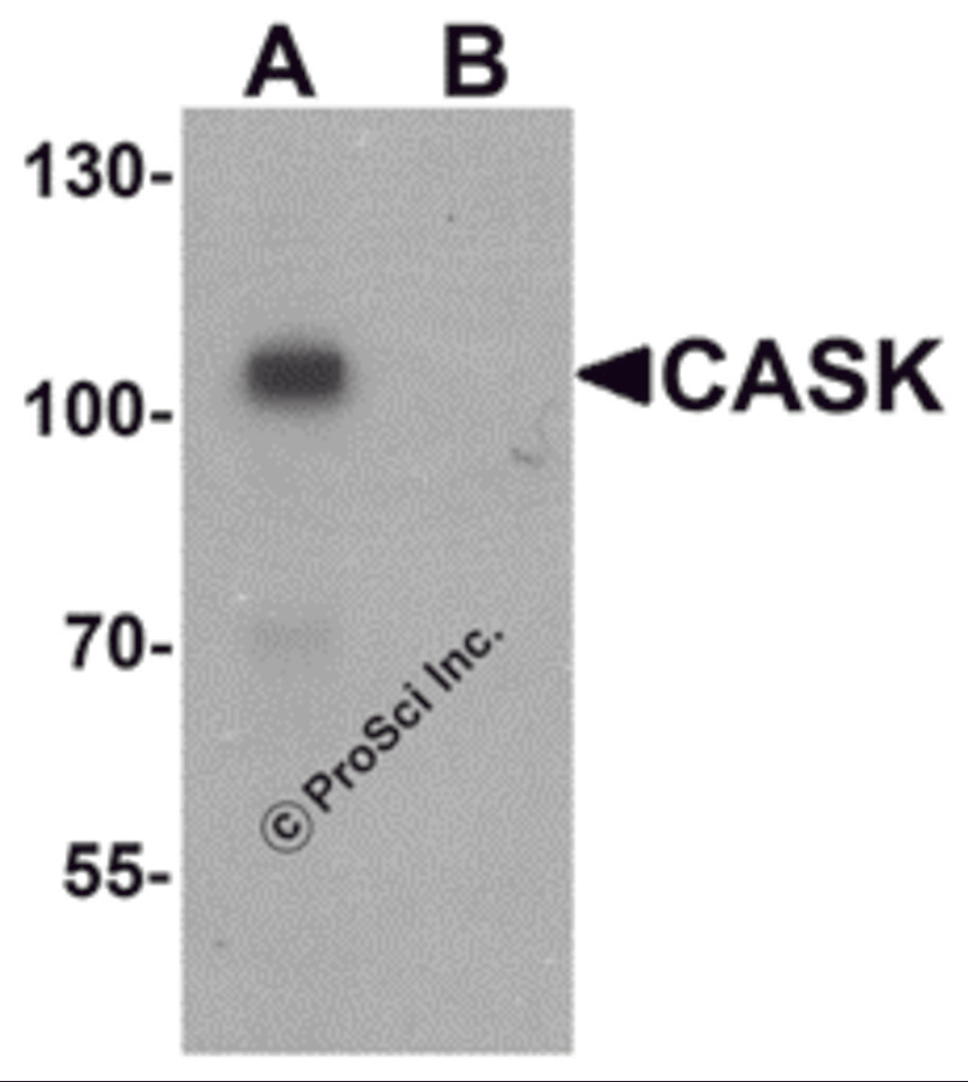 Western blot analysis of CASK in mouse brain tissue lysate with CASK antibody at 1 μg/ml in (A) the absence and (B) the presence of blocking peptide.
