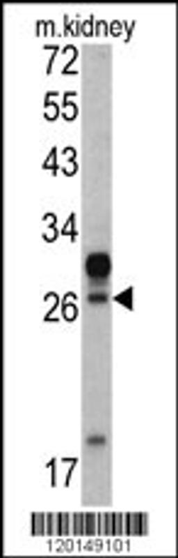 Western blot analysis of in mouse kidney tissue lysates (35ug/lane)