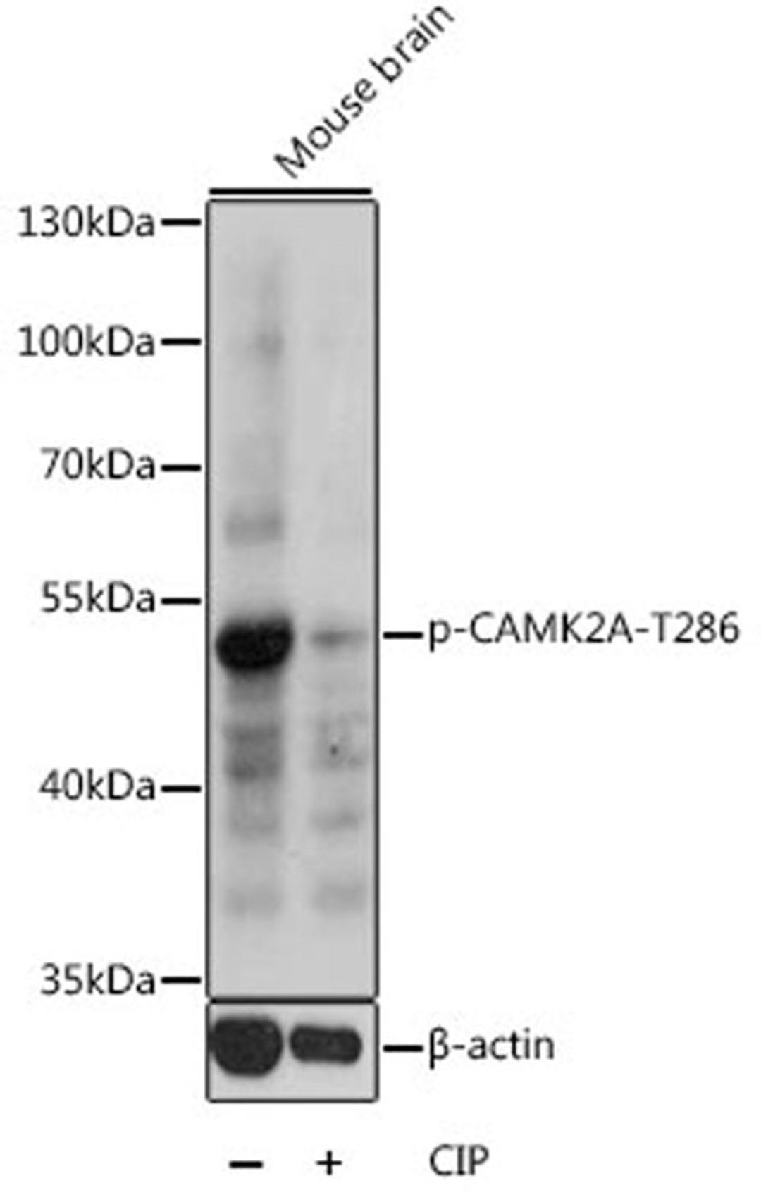 Western blot - Phospho-CAMK2A-T286 antibody (AP0255)