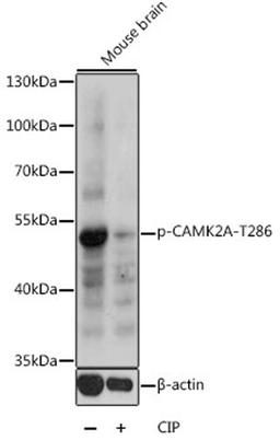 Western blot - Phospho-CAMK2A-T286 antibody (AP0255)