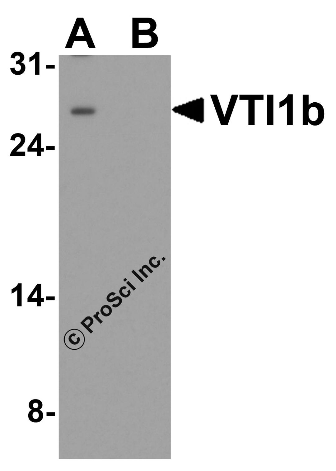 Western blot analysis of VTI1b in HeLa cell lysate with VTI1b antibody at 1 μg/ml in (A) the absence and (B) the presence of blocking peptide.
