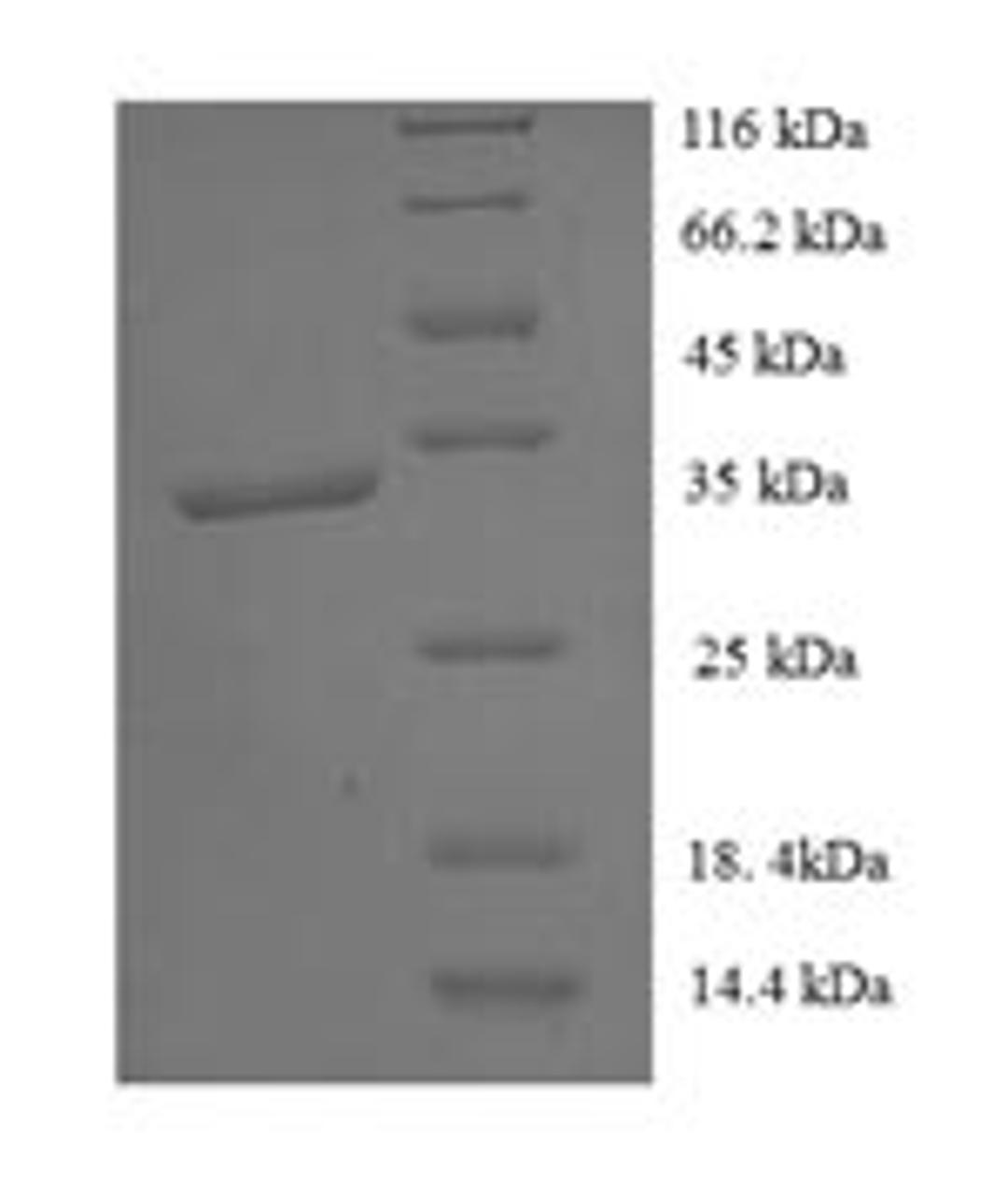 (Tris-Glycine gel) Discontinuous SDS-PAGE (reduced) with 5% enrichment gel and 15% separation gel.