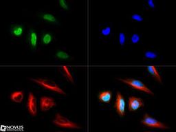 Immunocytochemistry/Immunofluorescence: LOX Antibody [NB100-2527] - LOX antibody was tested in HeLa cells with Dylight 488 (green). Nuclei and alpha-tubulin were counterstained with DAPI (blue) and Dylight 550 (red).