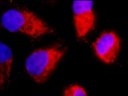 Immunofluorescence analysis of hela cells using TNF-R1 antibody