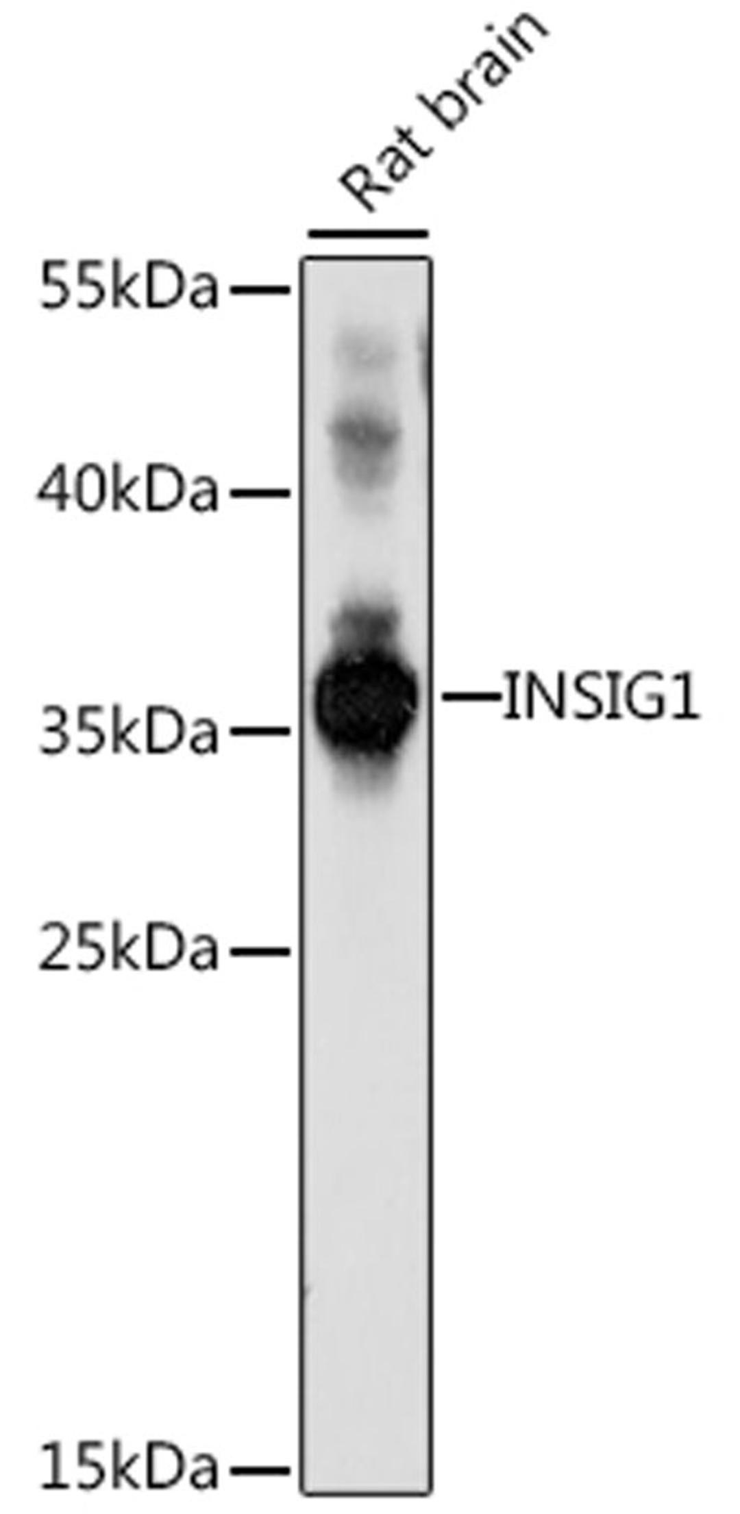 Western blot - INSIG1 antibody (A16278)