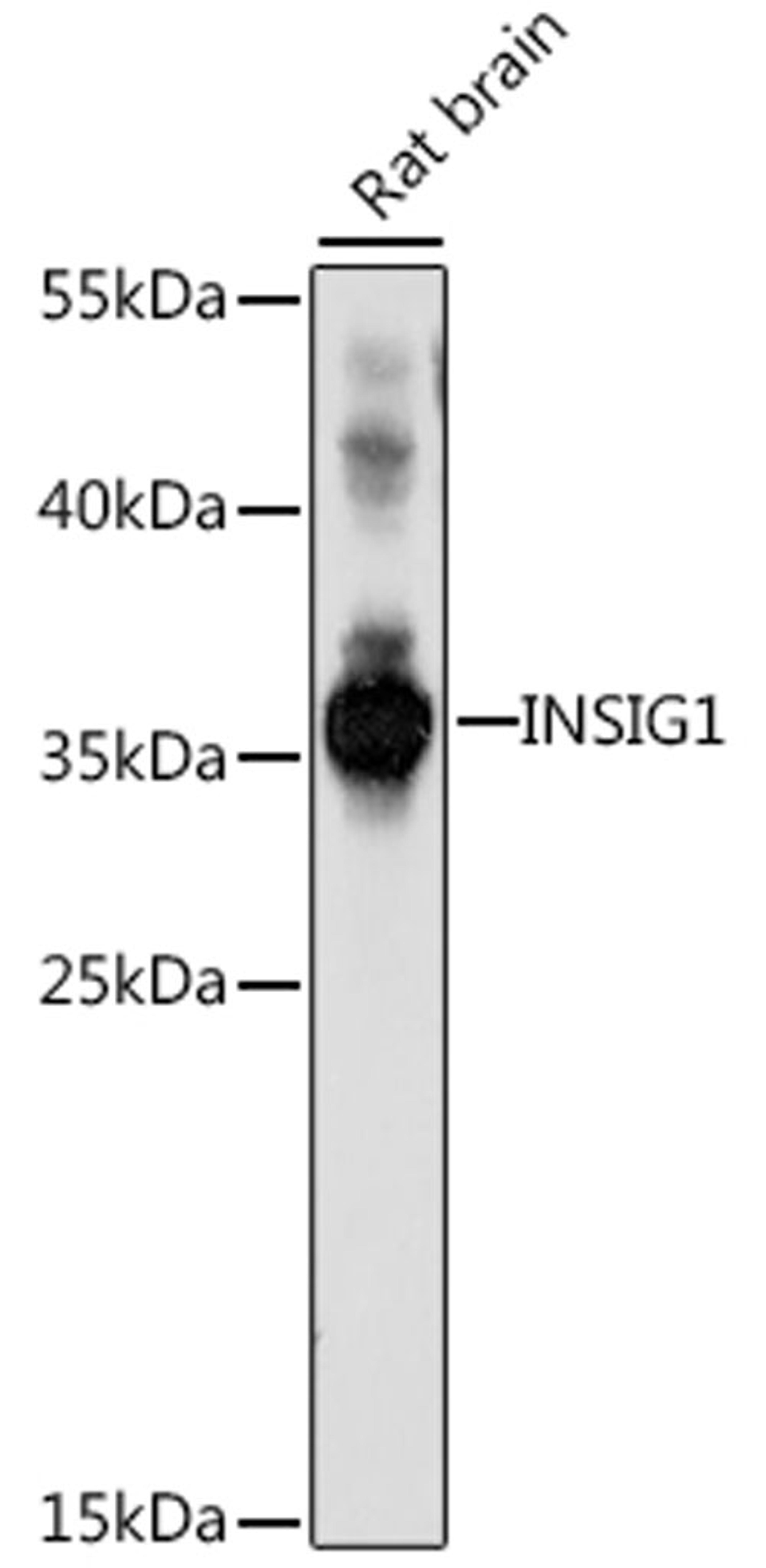 Western blot - INSIG1 antibody (A16278)