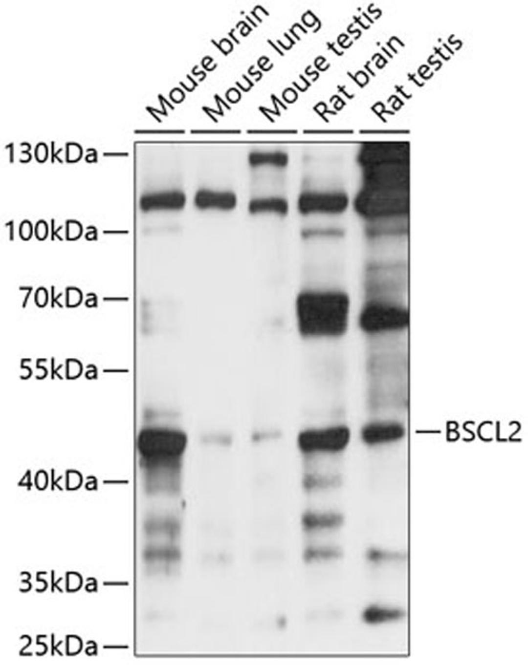 Western blot - BSCL2 antibody (A14583)