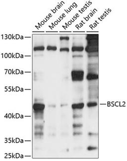 Western blot - BSCL2 antibody (A14583)