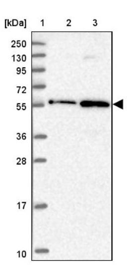 Western Blot: ZNF436 Antibody [NBP1-82897] - Lane 1: Marker [kDa] 250, 130, 95, 72, 55, 36, 28, 17, 10<br/>Lane 2: Human cell line RT-4<br/>Lane 3: Human cell line U-251MG sp