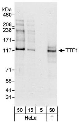 Detection of human TTF1 by western blot.