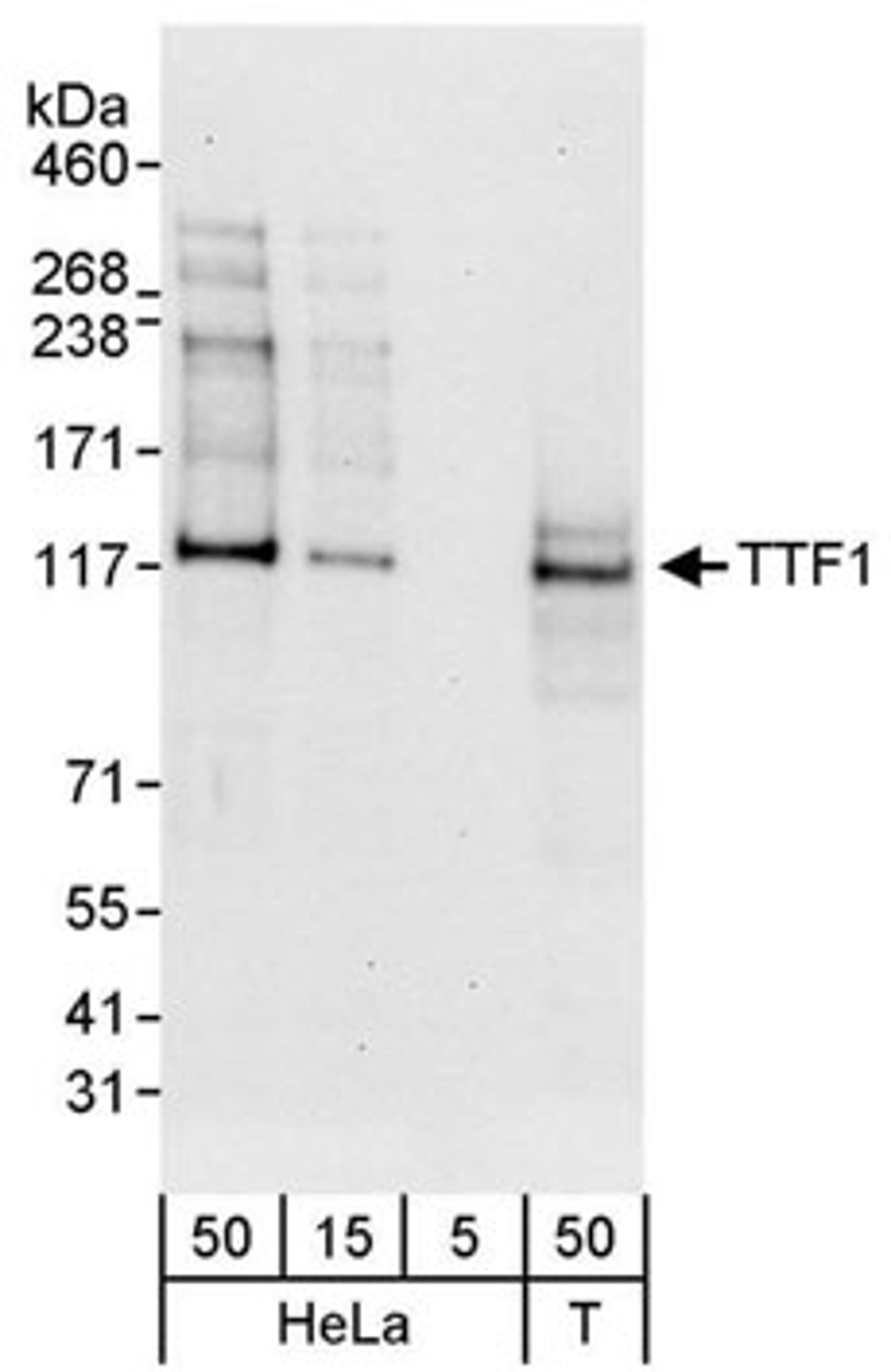 Detection of human TTF1 by western blot.