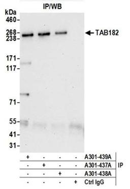 Detection of human TAB182 by western blot of immunoprecipitates.