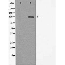 Western blot analysis of mouse brain using GluR8 antibody