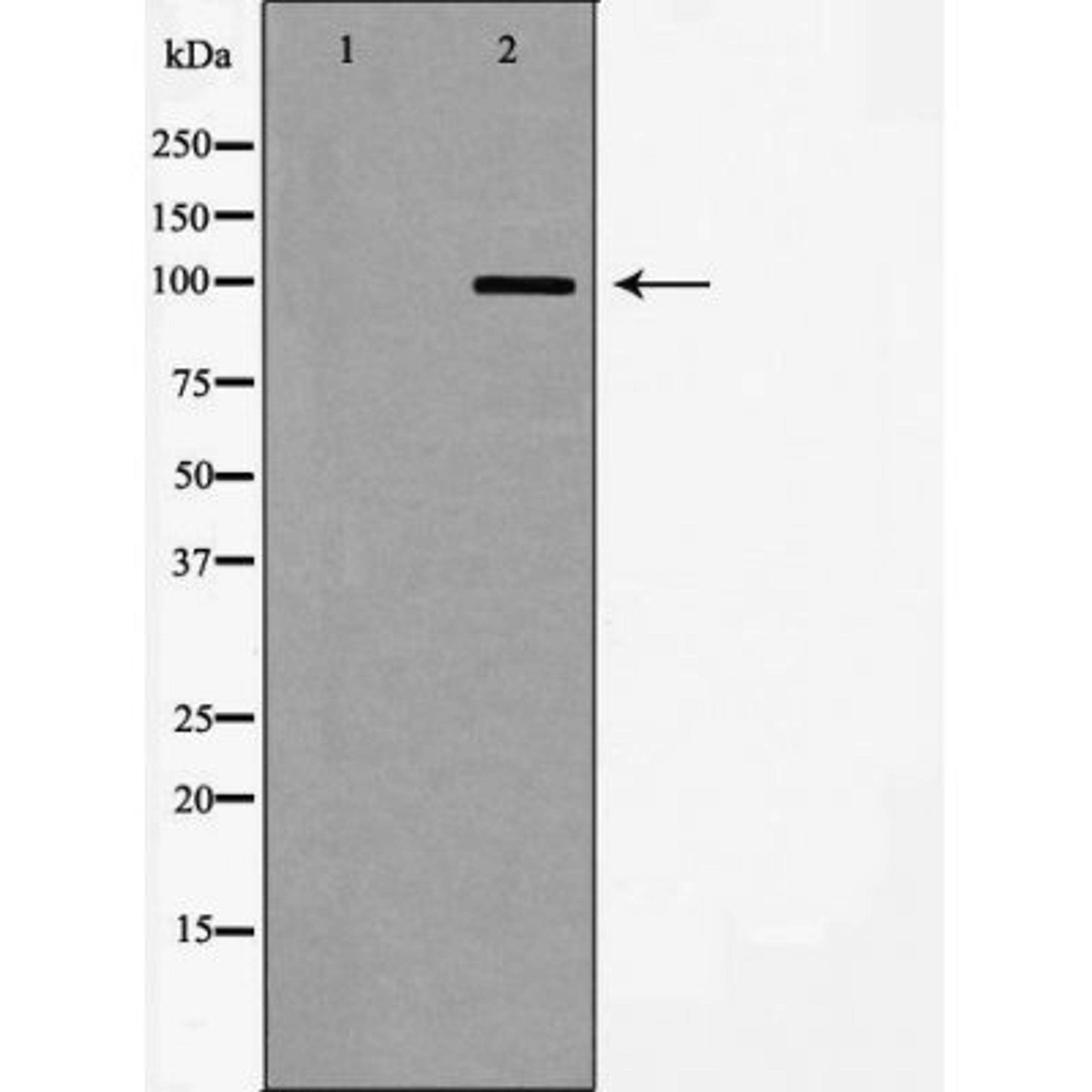 Western blot analysis of mouse brain using GluR8 antibody