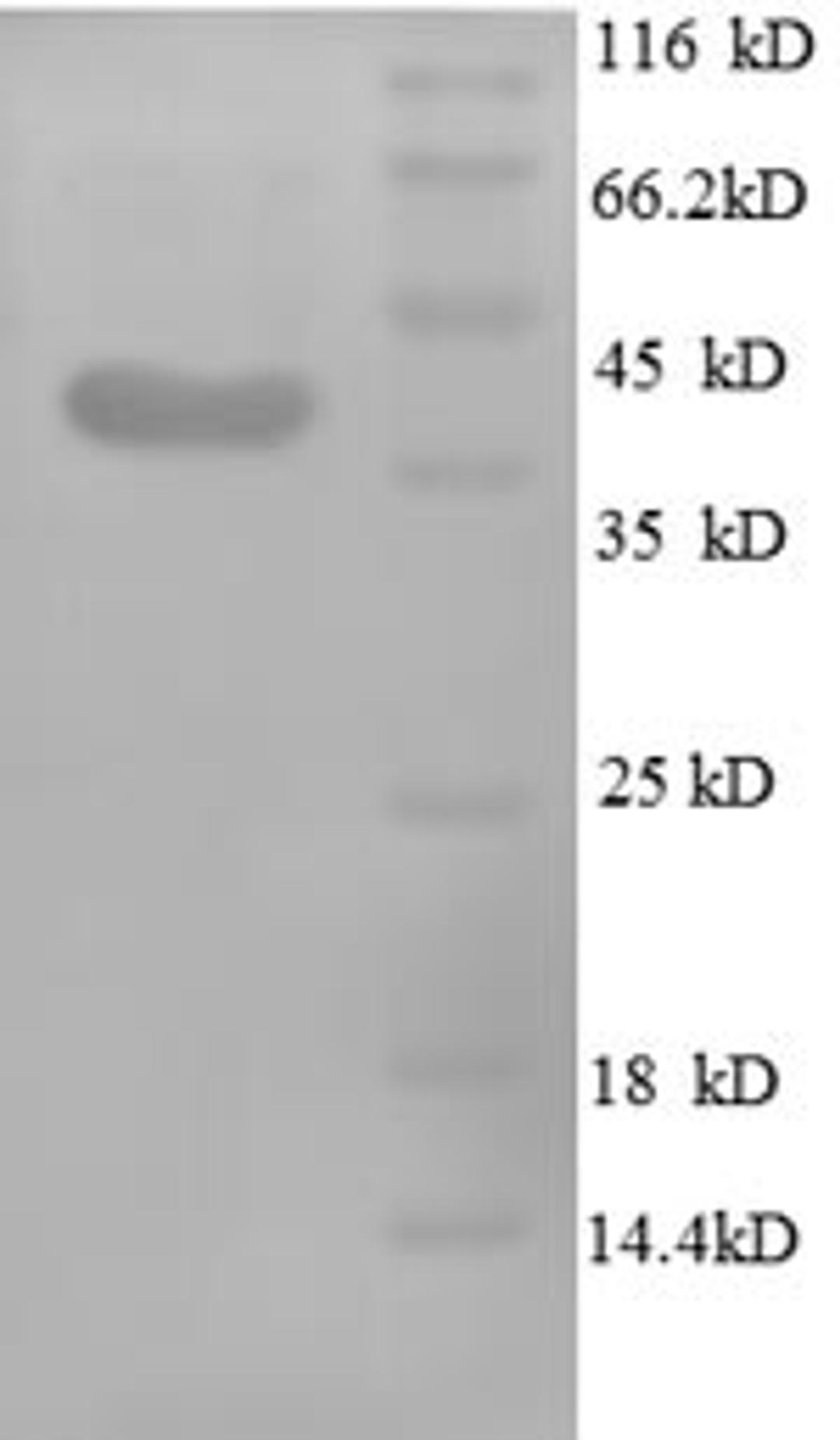 (Tris-Glycine gel) Discontinuous SDS-PAGE (reduced) with 5% enrichment gel and 15% separation gel.