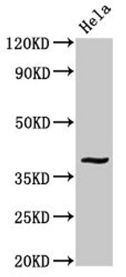 Western Blot. Positive WB detected in: Hela whole cell lysate. All lanes: DUSP1 antibody at 3.4ug/ml. Secondary. Goat polyclonal to rabbit IgG at 1/50000 dilution. Predicted band size: 40 kDa. Observed band size: 40 kDa. 