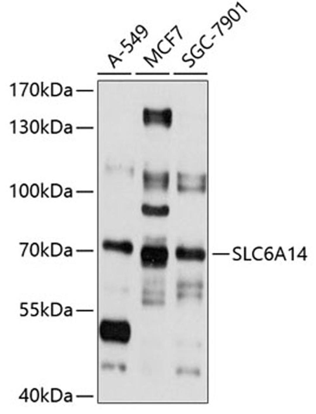 Western blot - SLC6A14 antibody (A10582)