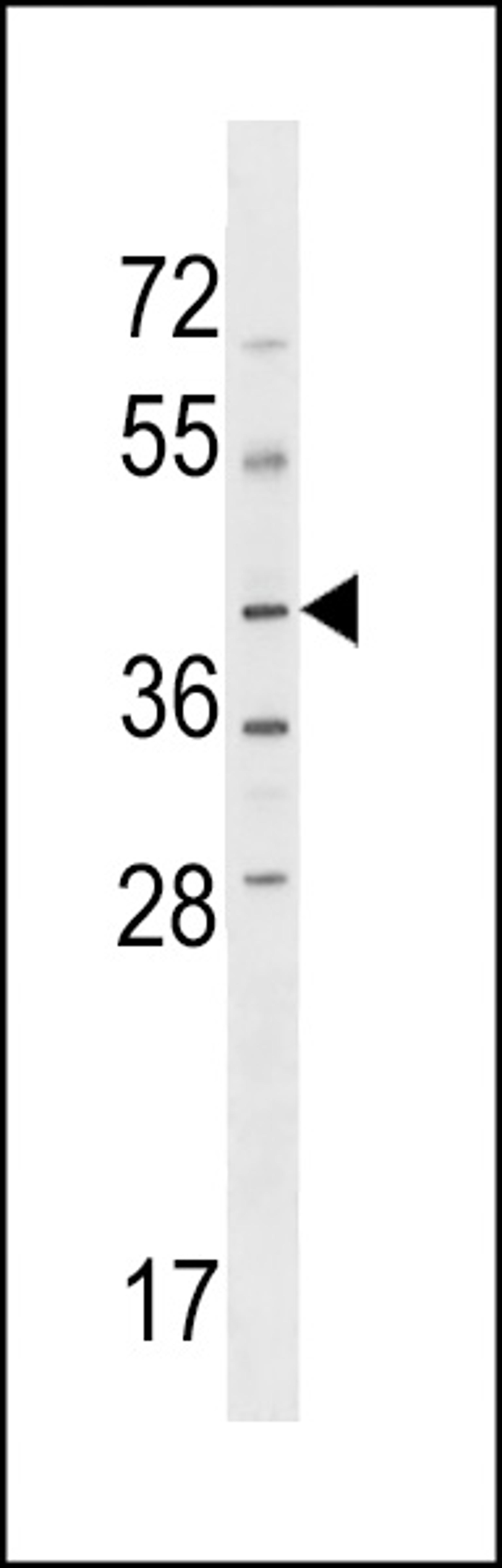 Western blot analysis in HL-60 cell line lysates (35ug/lane).