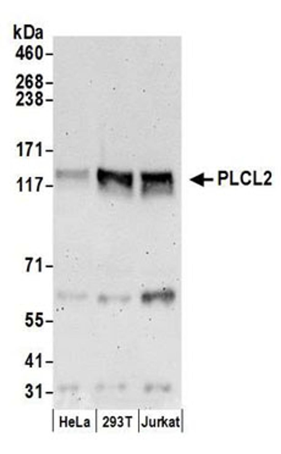 Detection of human PLCL2 by western blot.