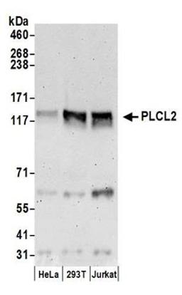 Detection of human PLCL2 by western blot.