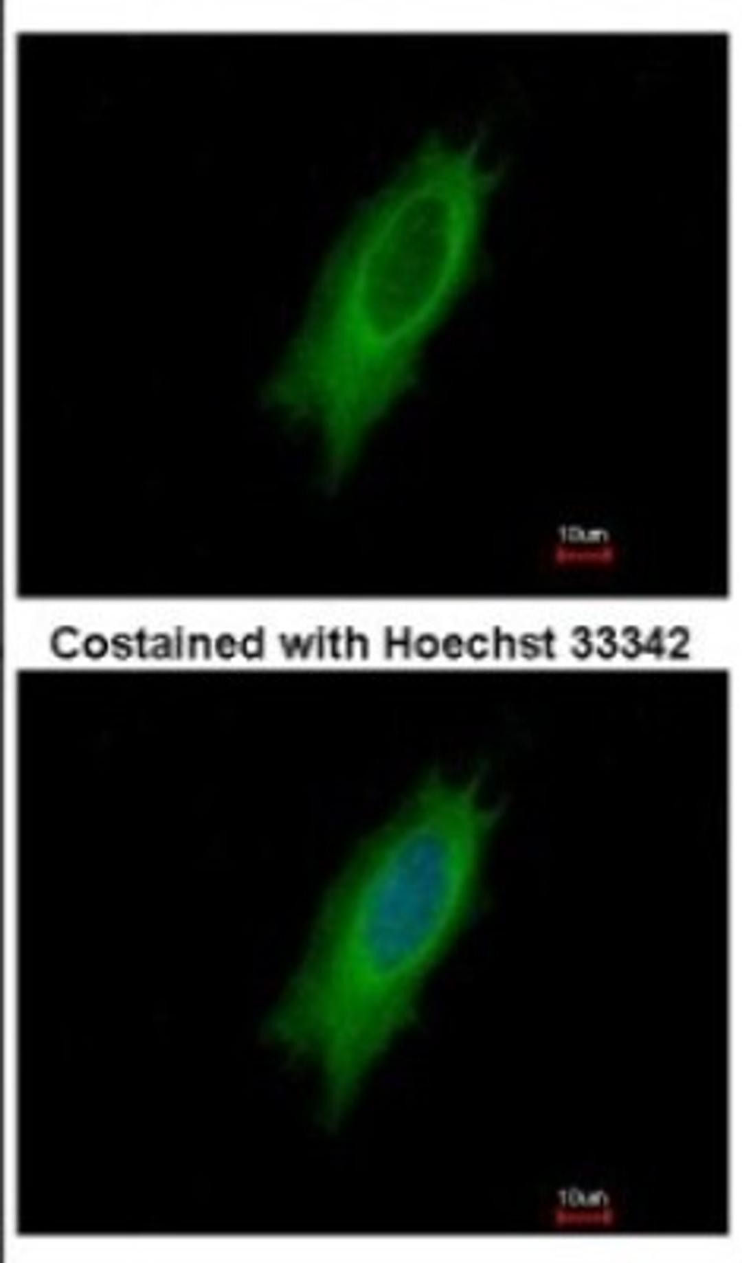 Immunocytochemistry/Immunofluorescence: HLA DPA Antibody [NBP2-16851] - Immunofluorescence analysis of methanol-fixed HeLa, using antibody at 1:500 dilution.