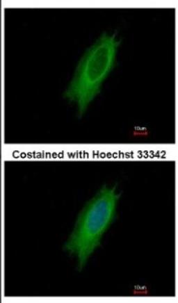 Immunocytochemistry/Immunofluorescence: HLA DPA Antibody [NBP2-16851] - Immunofluorescence analysis of methanol-fixed HeLa, using antibody at 1:500 dilution.