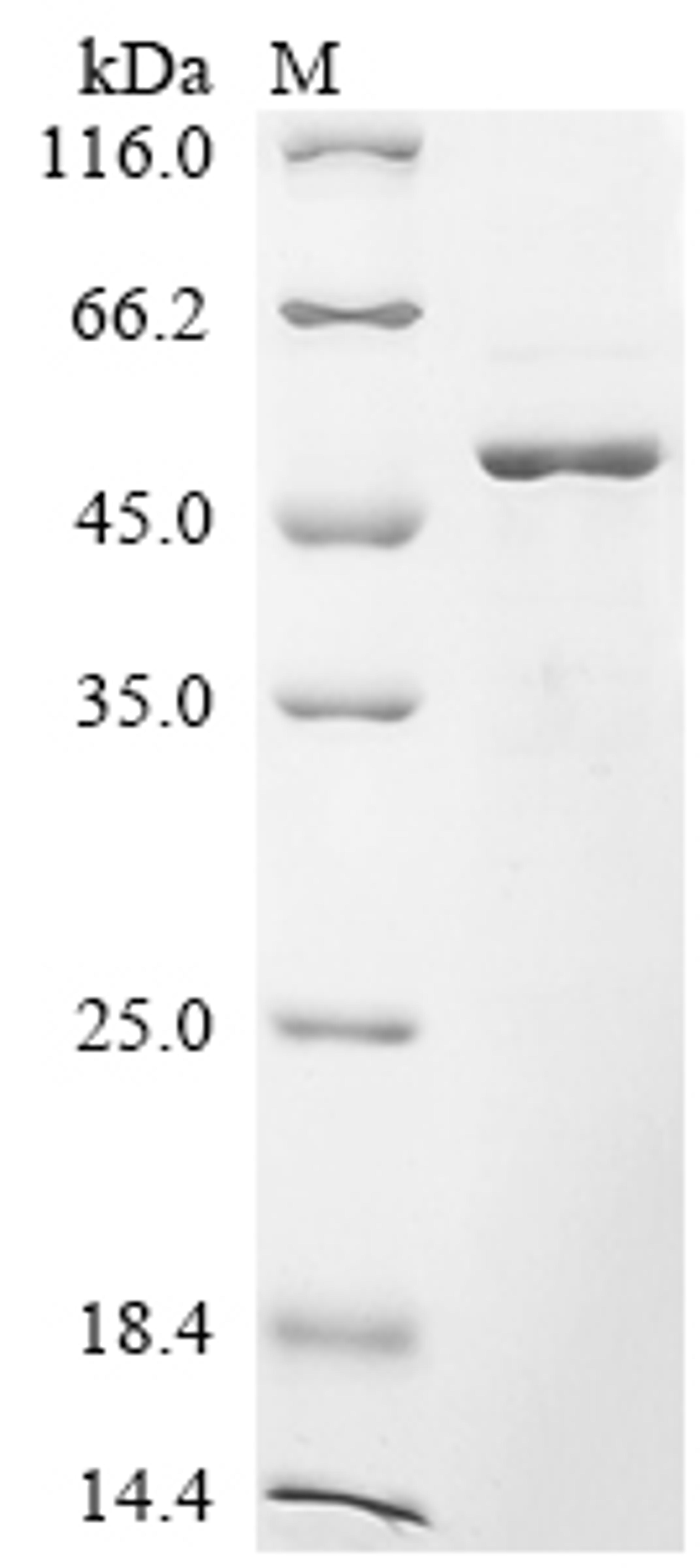 (Tris-Glycine gel) Discontinuous SDS-PAGE (reduced) with 5% enrichment gel and 15% separation gel.