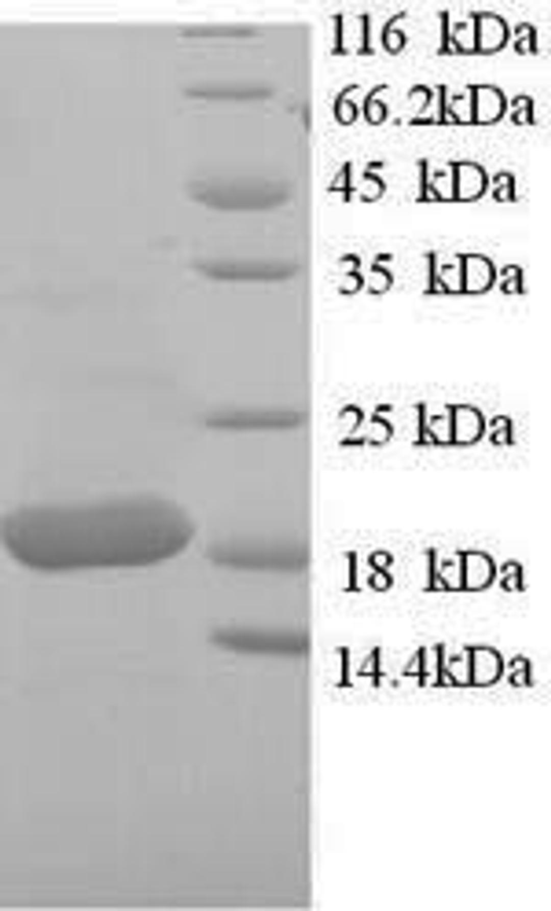 (Tris-Glycine gel) Discontinuous SDS-PAGE (reduced) with 5% enrichment gel and 15% separation gel.