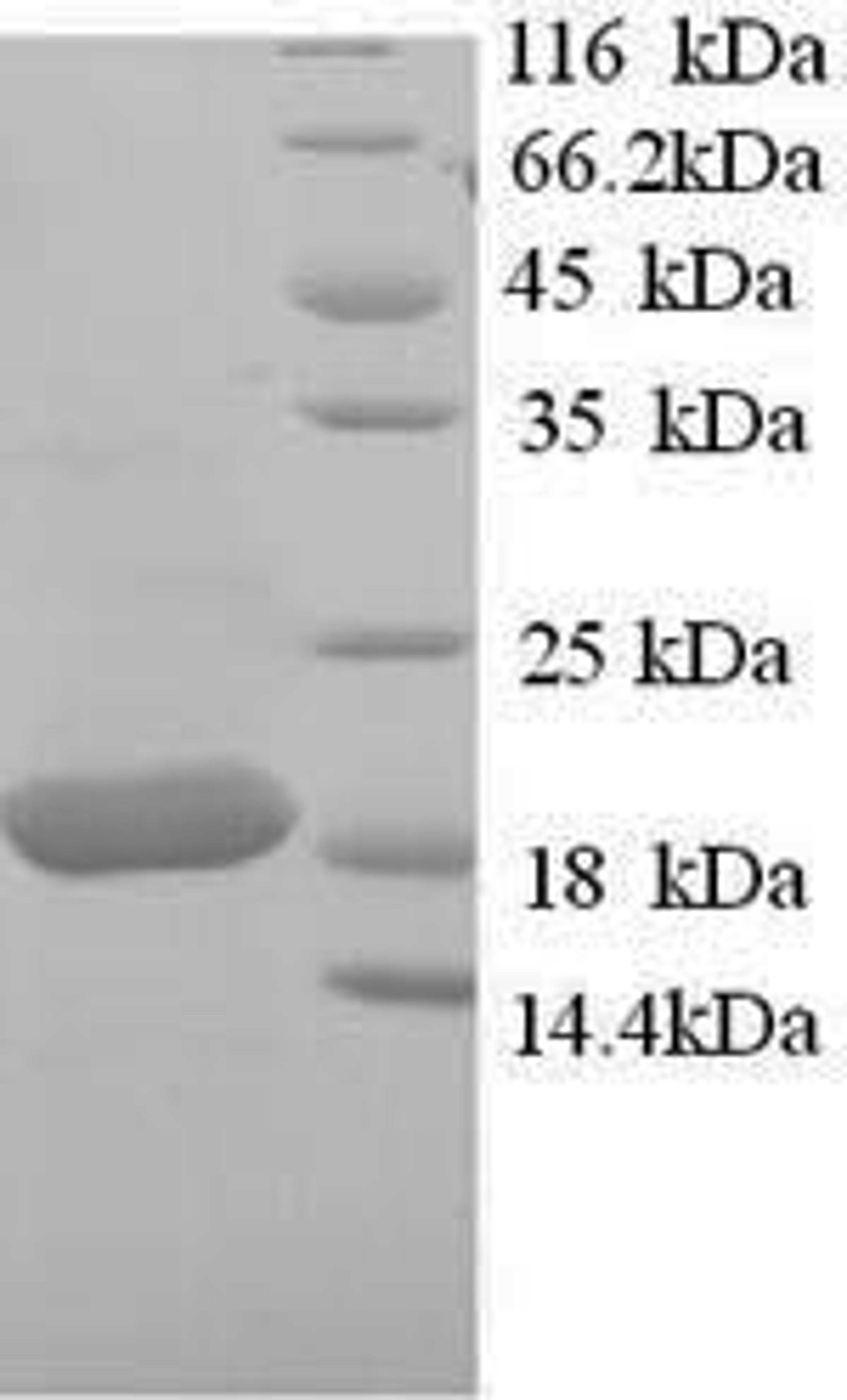 (Tris-Glycine gel) Discontinuous SDS-PAGE (reduced) with 5% enrichment gel and 15% separation gel.