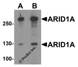 Western blot analysis of ARID1A in SK-N-SH cell lysate with ARID1A antibody at (A) 1 and (B) 2 μg/ml.