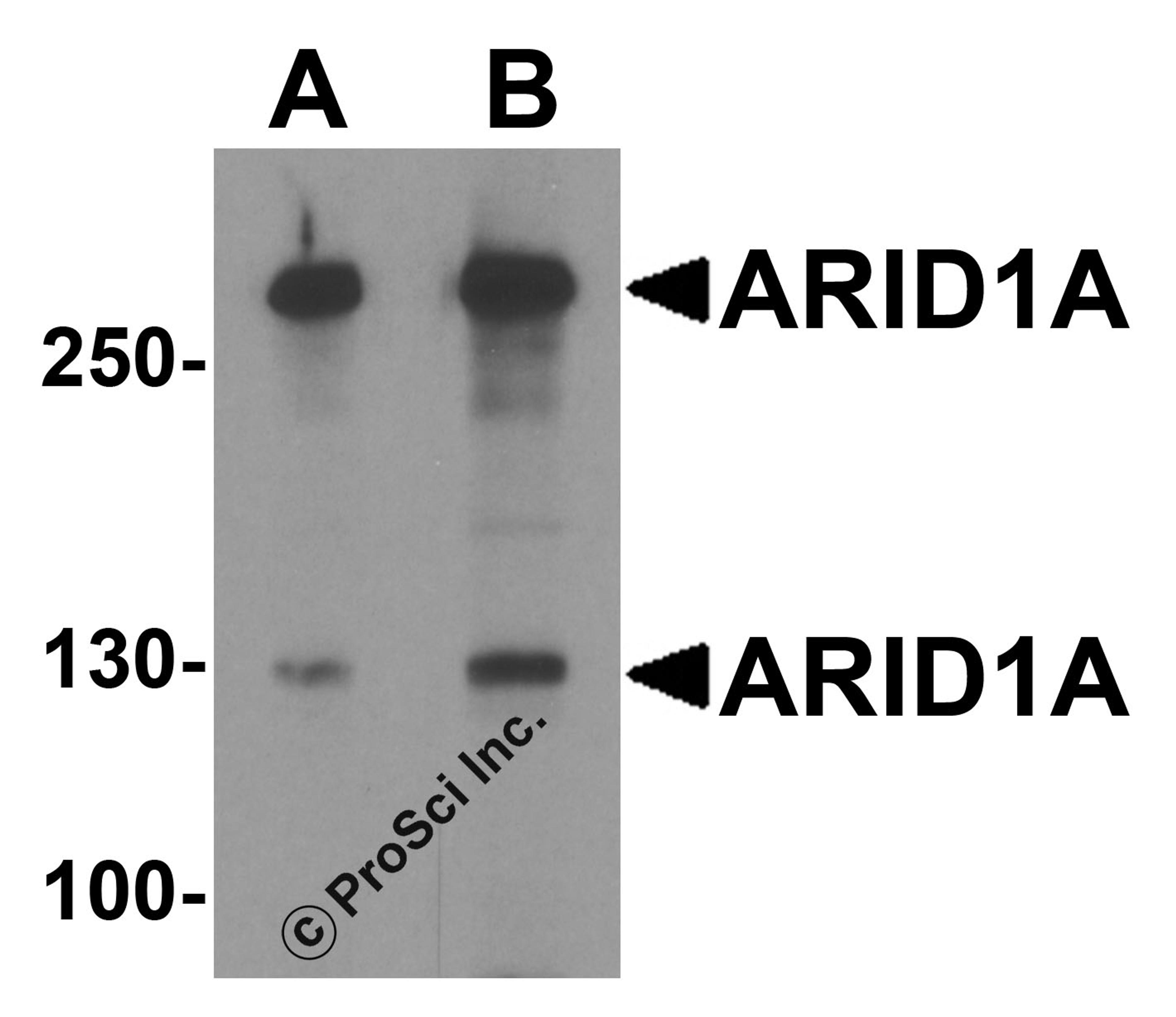 Western blot analysis of ARID1A in SK-N-SH cell lysate with ARID1A antibody at (A) 1 and (B) 2 μg/ml.