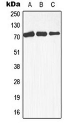 Western blot analysis of Raji (Lane 1), A431 (Lane 2), HepG2 (Lane 3) whole cell lysates using MAP3K3 antibody