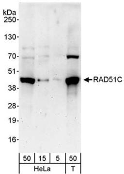 Detection of human RAD51C by western blot.