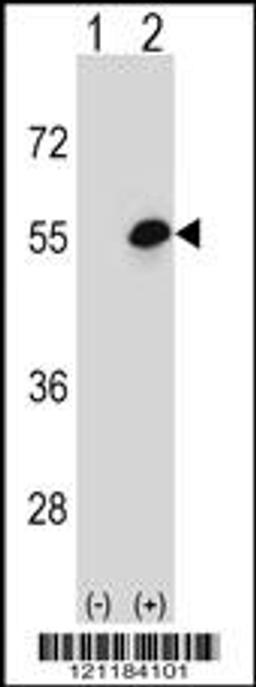 Western blot analysis of COCH using rabbit polyclonal COCH Antibody using 293 cell lysates (2 ug/lane) either nontransfected (Lane 1) or transiently transfected (Lane 2) with the COCH gene.