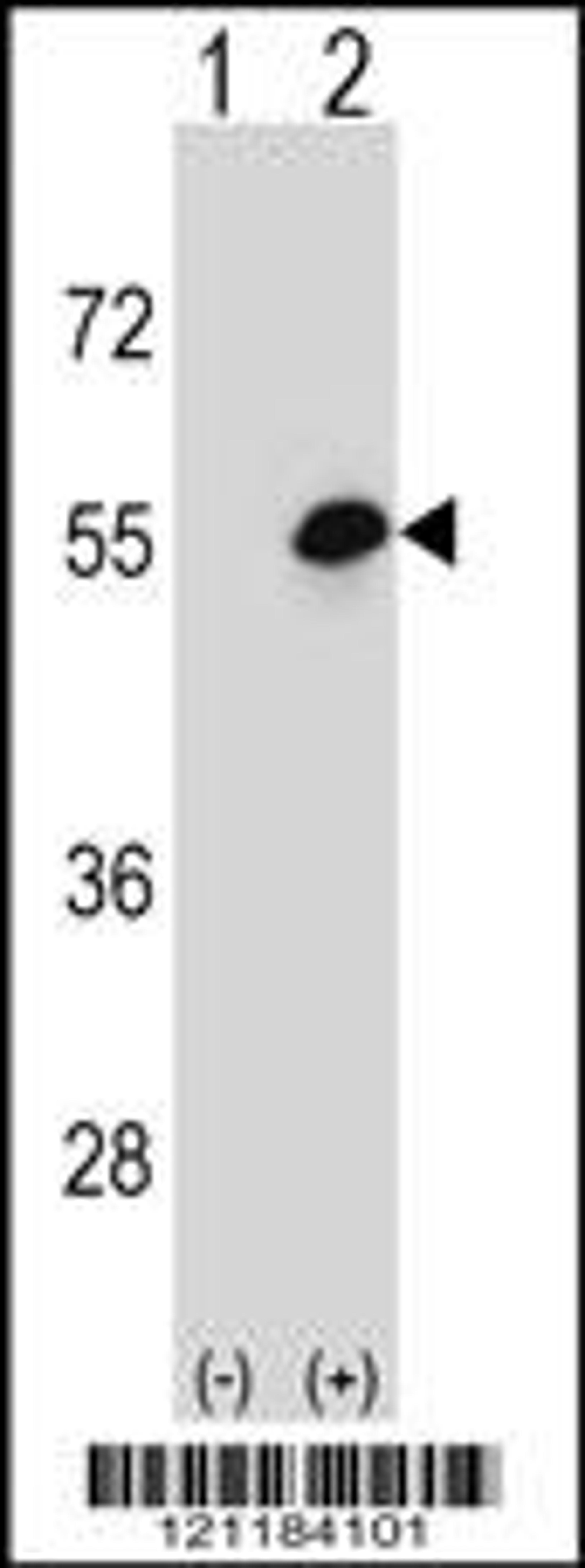 Western blot analysis of COCH using rabbit polyclonal COCH Antibody using 293 cell lysates (2 ug/lane) either nontransfected (Lane 1) or transiently transfected (Lane 2) with the COCH gene.