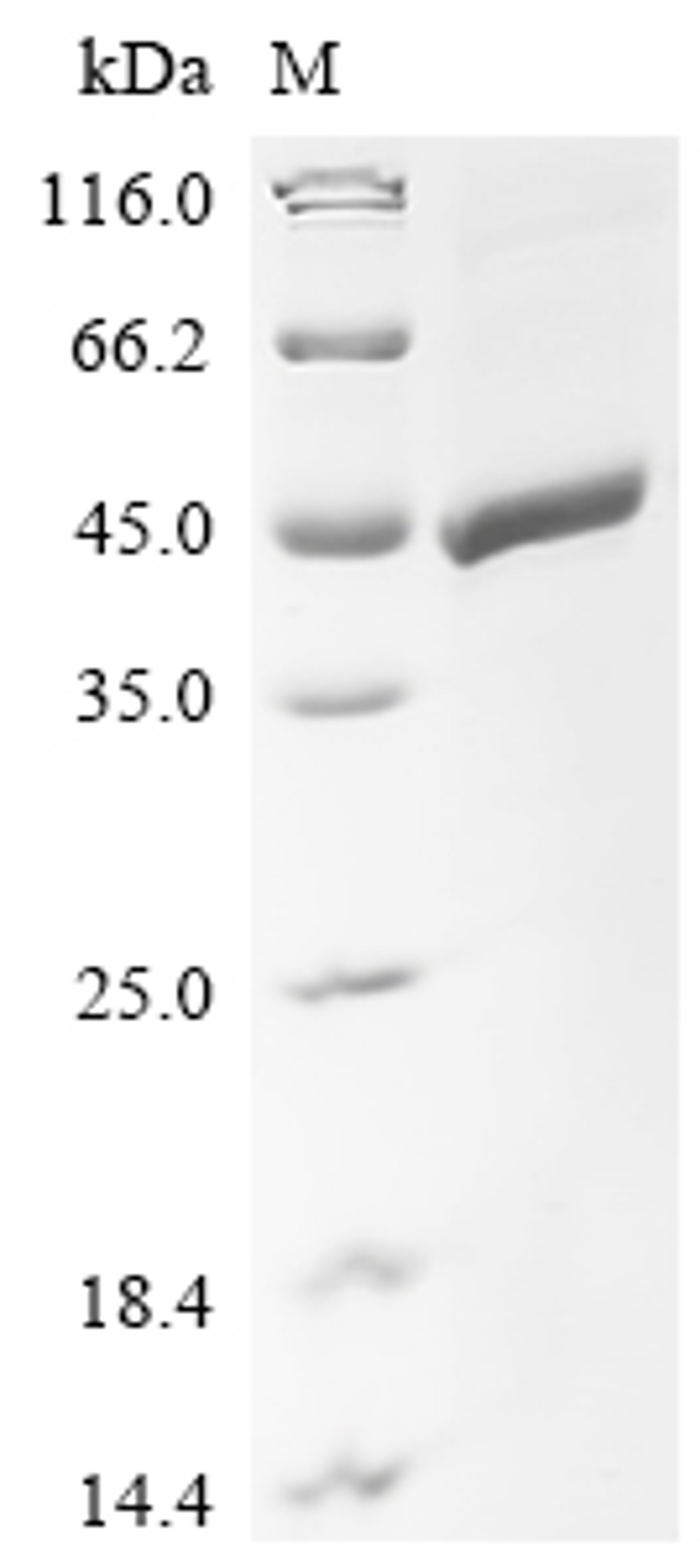 (Tris-Glycine gel) Discontinuous SDS-PAGE (reduced) with 5% enrichment gel and 15% separation gel.