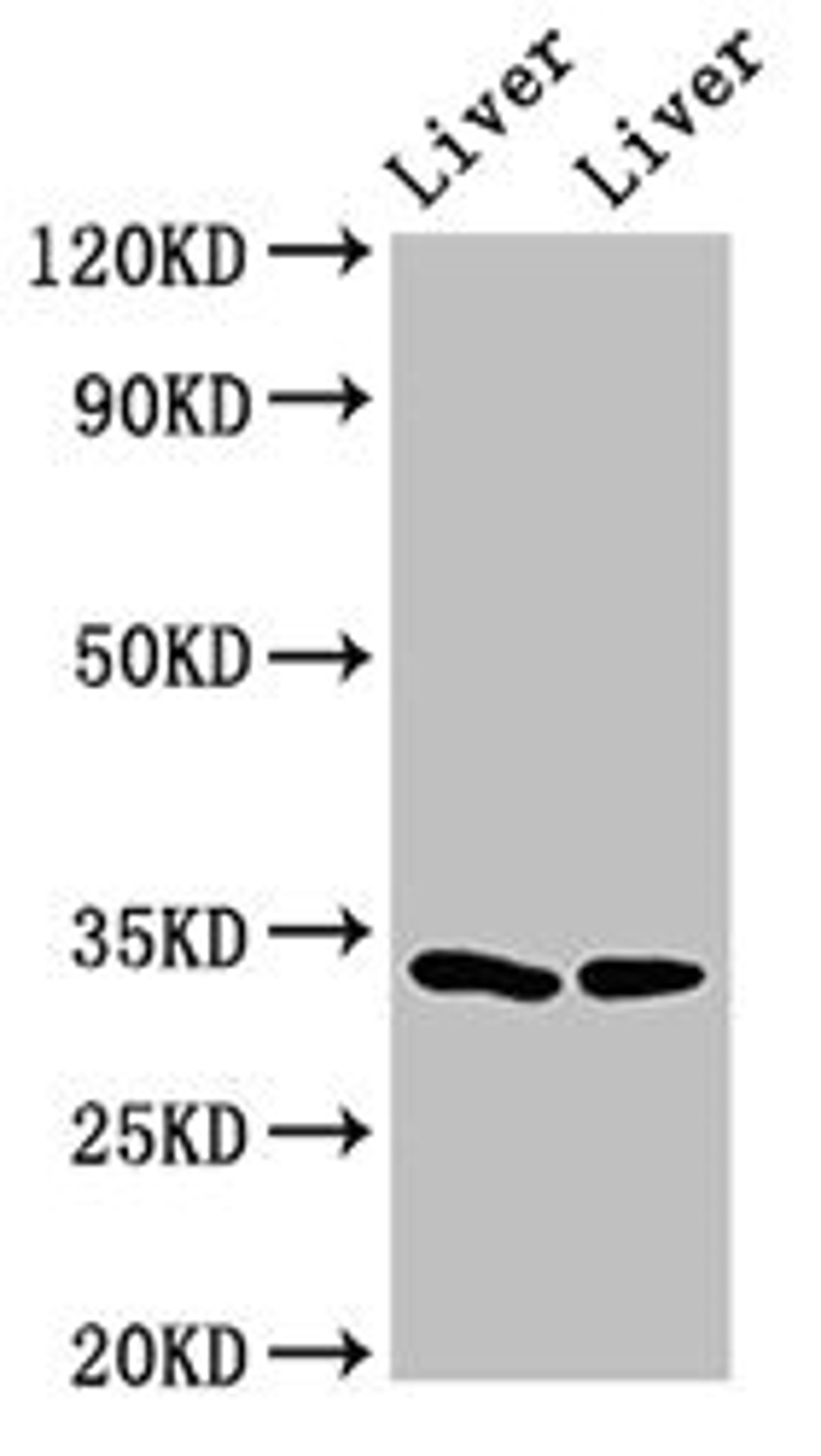 Western Blot. Positive WB detected in: Rat liver tissue, Mouse liver tissue. All lanes: RGN antibody at 3ug/ml. Secondary. Goat polyclonal to rabbit IgG at 1/50000 dilution. Predicted band size: 34, 25 kDa. Observed band size: 34 kDa.