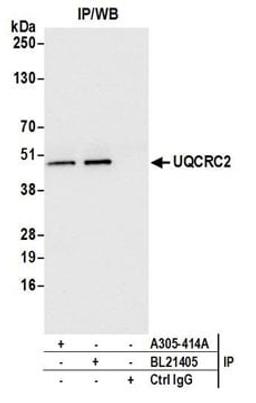 Detection of human UQCRC2 by western blot of immunoprecipitates.