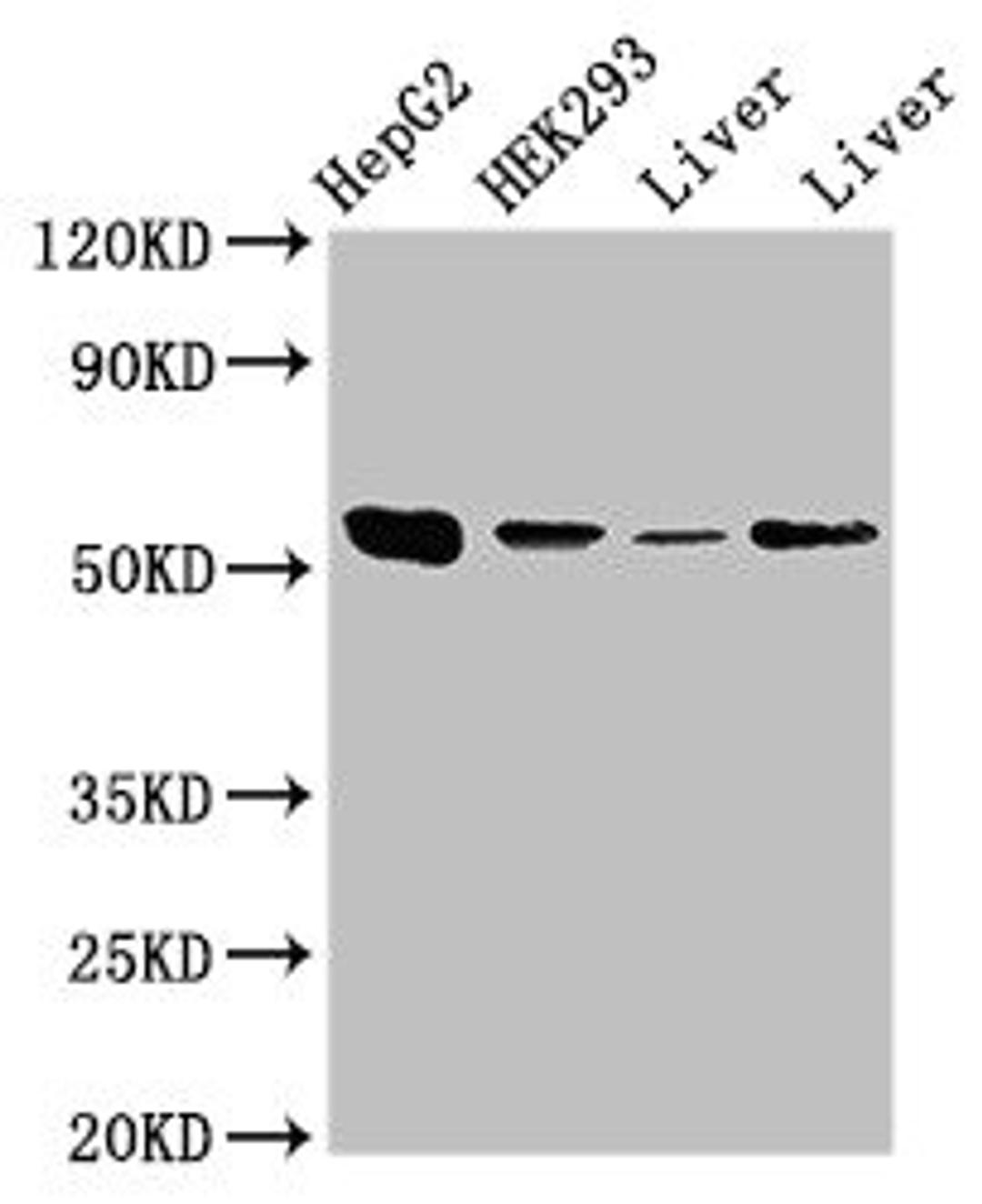 Western Blot. Positive WB detected in: HepG2 whole cell lysate, HEK293 whole cell lysate, Rat liver tissue, Mouse liver tissue. All lanes: MAP2K5 antibody at 3.5µg/ml. Secondary. Goat polyclonal to rabbit IgG at 1/50000 dilution. Predicted band size: 51, 49, 50, 47 kDa. Observed band size: 51 kDa