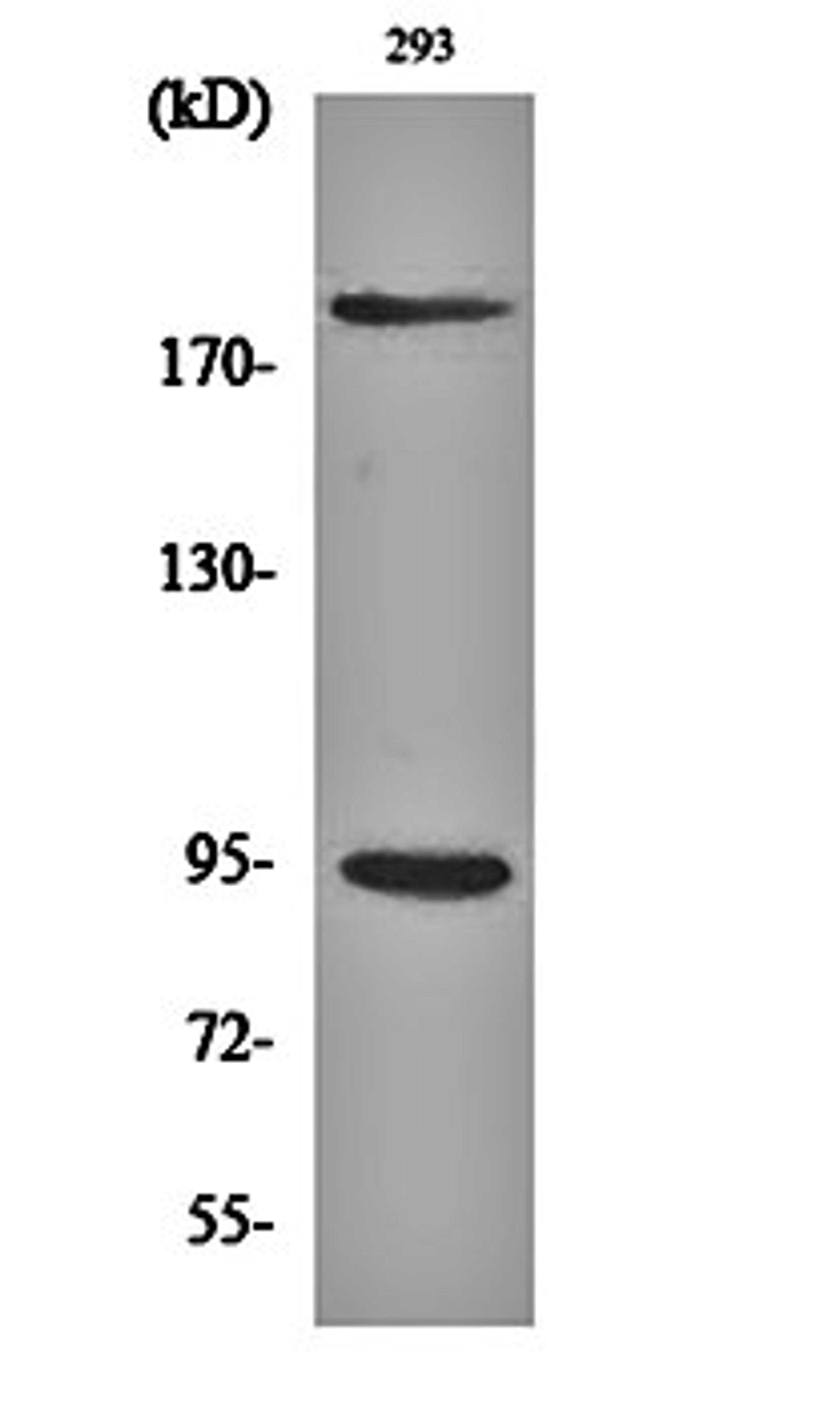 Western blot analysis of 293 cell lysates using IGF-IR (phospho-Y1161) antibody