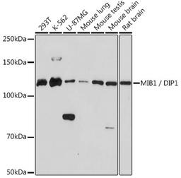 Western blot - MIB1 / DIP1 Rabbit mAb (A3371)